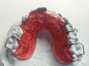 Prótesis dentales y estética dental