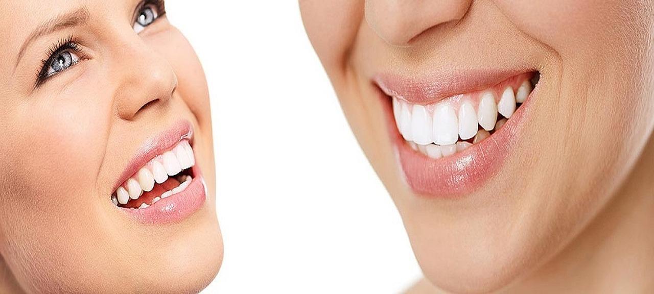 Coronas, carillas, puentes y otros elementos de la estética dental