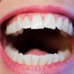 5 consejos para prevenir la formación del sarro y los dientes amarillentos